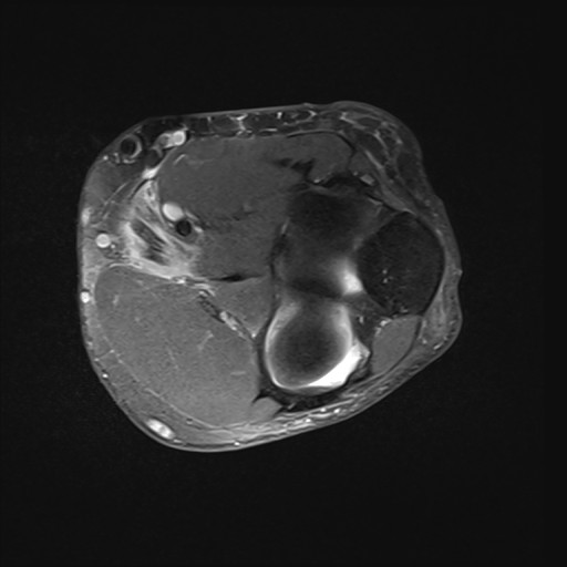 Click on the Serie image to view the images of Wieszt, Gnter